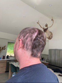 The disastrous aftermath of my DIY haircut attempt